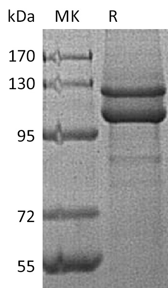 Human CDH1 +SDS-PAGE-2.jpg